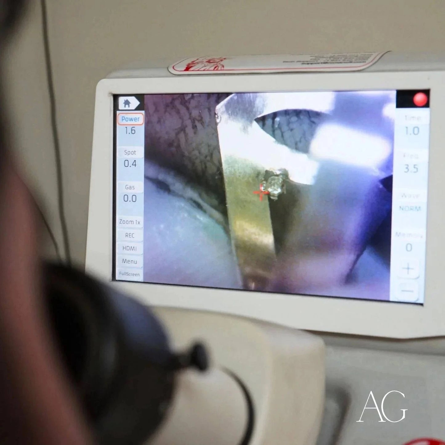 Medical imaging device showcasing ultrasound view for Art Gold jewelry repair